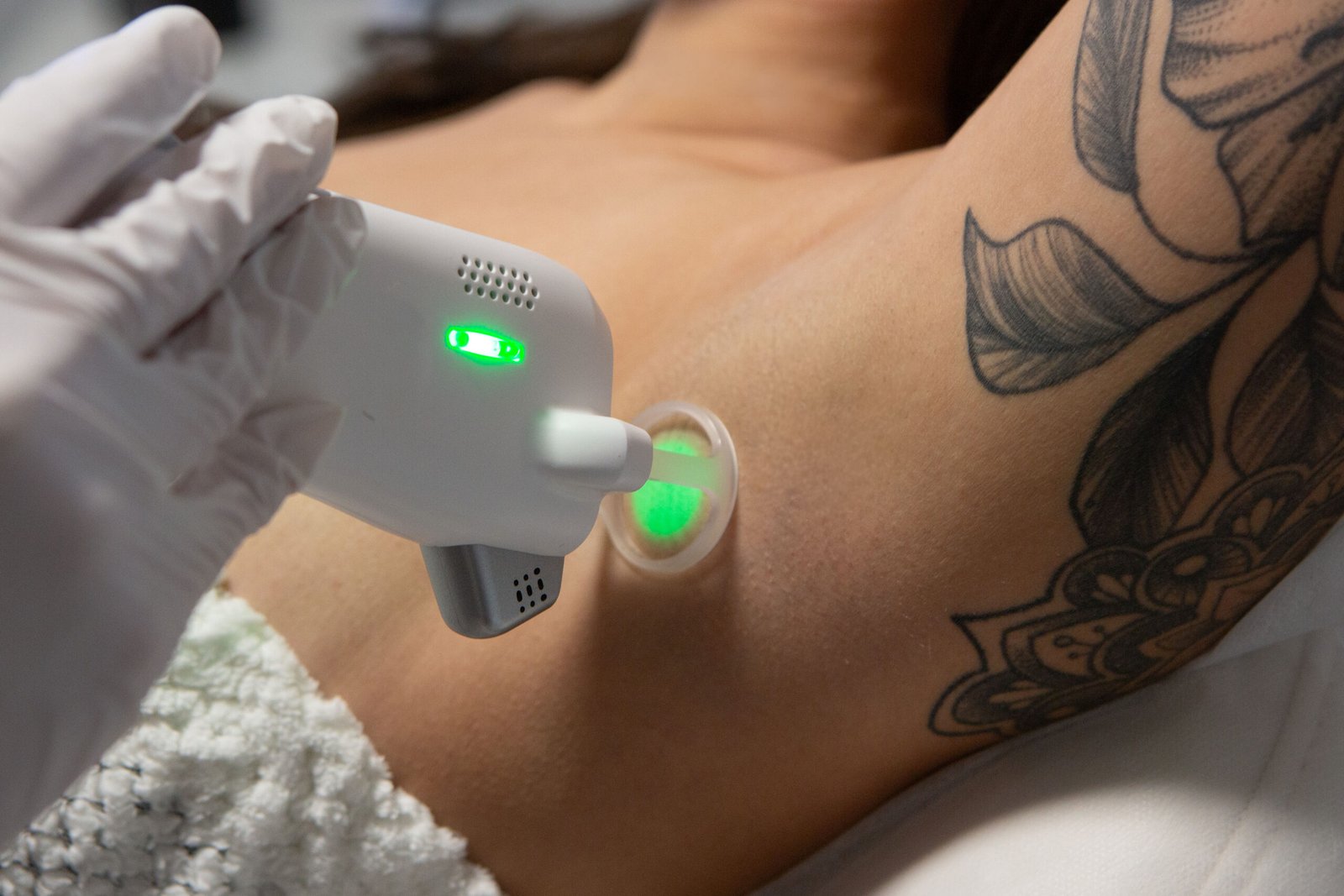 does laser hair removal hurt